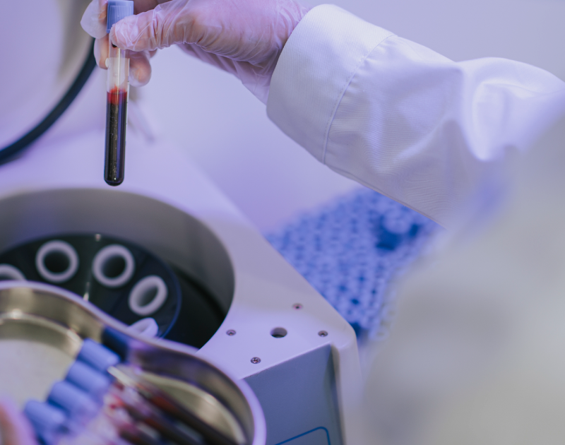 Plasma Rico en Plaquetas (PRP):