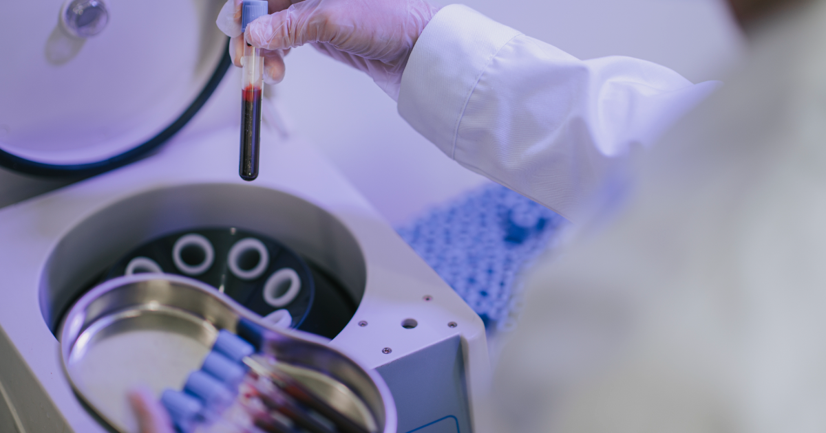 Plasma Rico en Plaquetas (PRP): un tratamiento innovador en Ginesalud